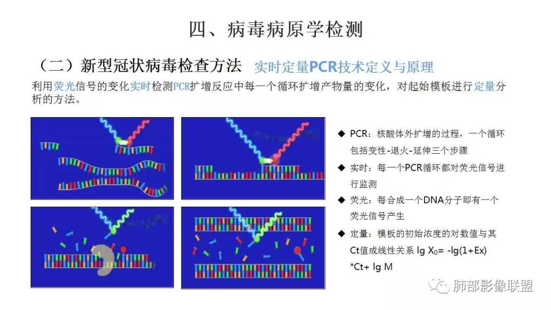【PPT】新型冠状病毒肺炎的鉴别诊断