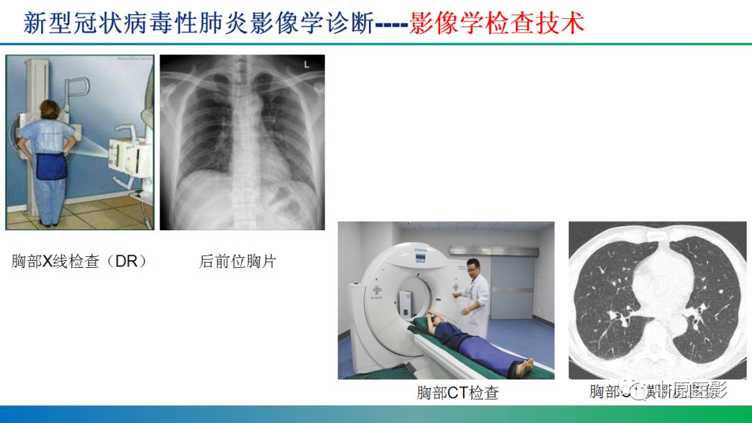 【PPT】新型冠状病毒肺炎影像学诊断浅析