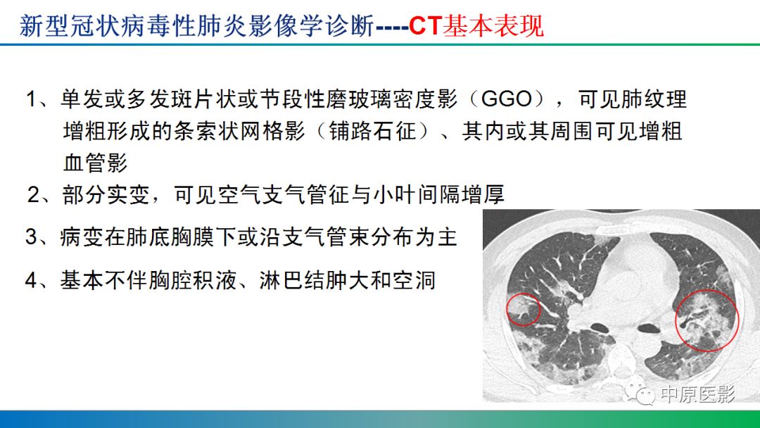 【PPT】新型冠状病毒肺炎影像学诊断浅析