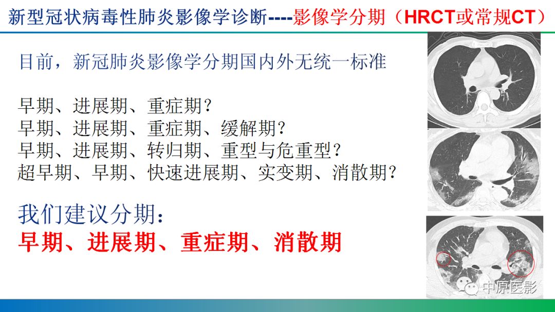 【PPT】新型冠状病毒肺炎影像学诊断浅析