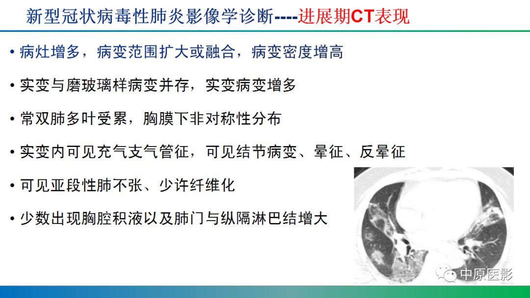 【PPT】新型冠状病毒肺炎影像学诊断浅析