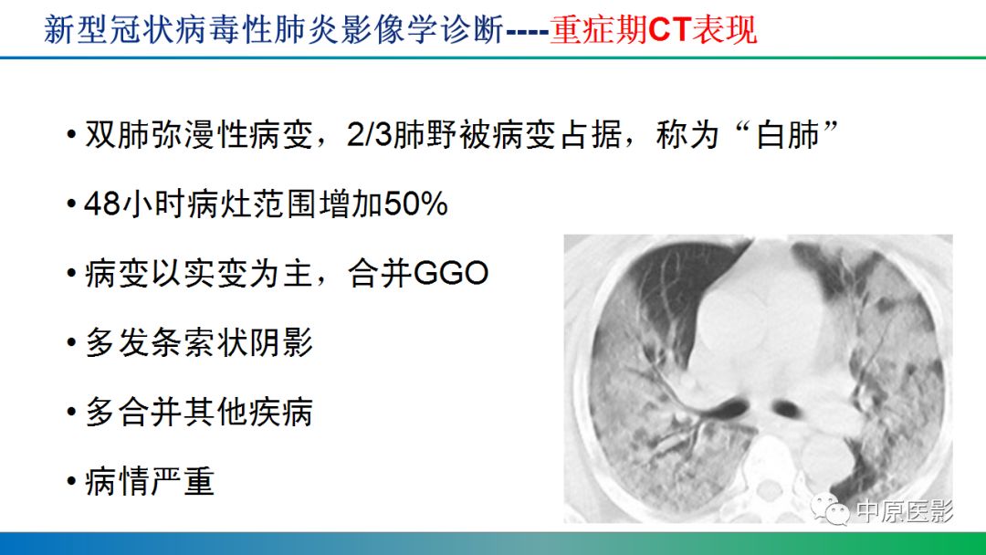 【PPT】新型冠状病毒肺炎影像学诊断浅析