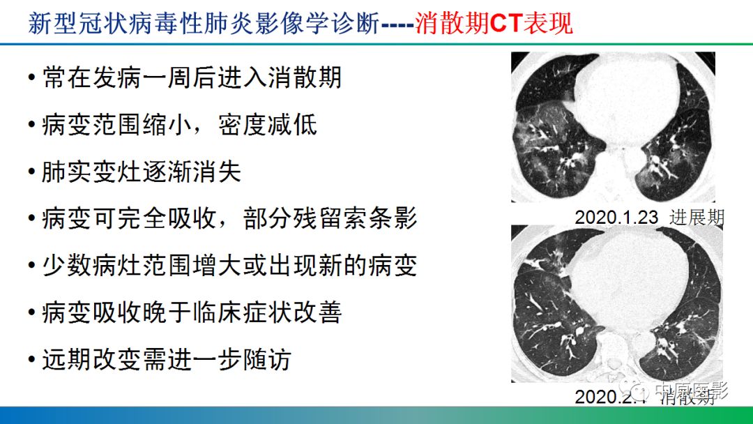 【PPT】新型冠状病毒肺炎影像学诊断浅析