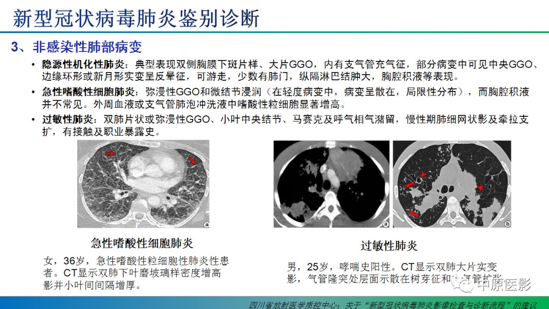 【PPT】新型冠状病毒肺炎影像学诊断浅析