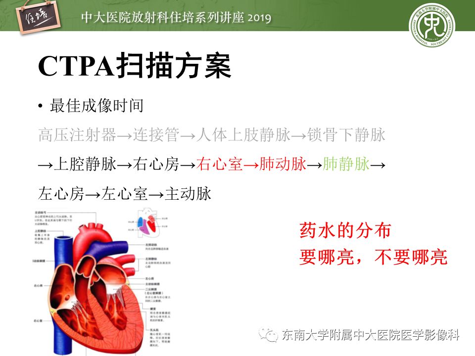 【PPT】肺动脉栓塞扫描流程、三维重建及影像评估