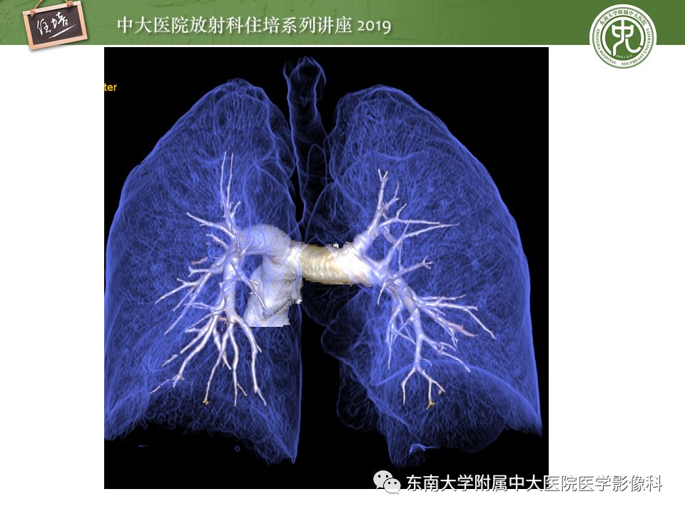 【PPT】肺动脉栓塞扫描流程、三维重建及影像评估