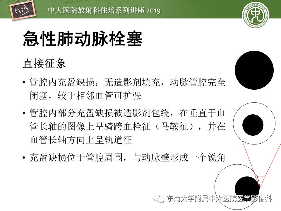 【PPT】肺动脉栓塞扫描流程、三维重建及影像评估