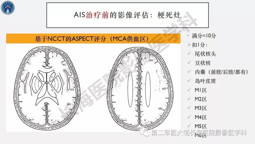 【PPT】2019中国《急性缺血性脑血管病影像指导规范》解读