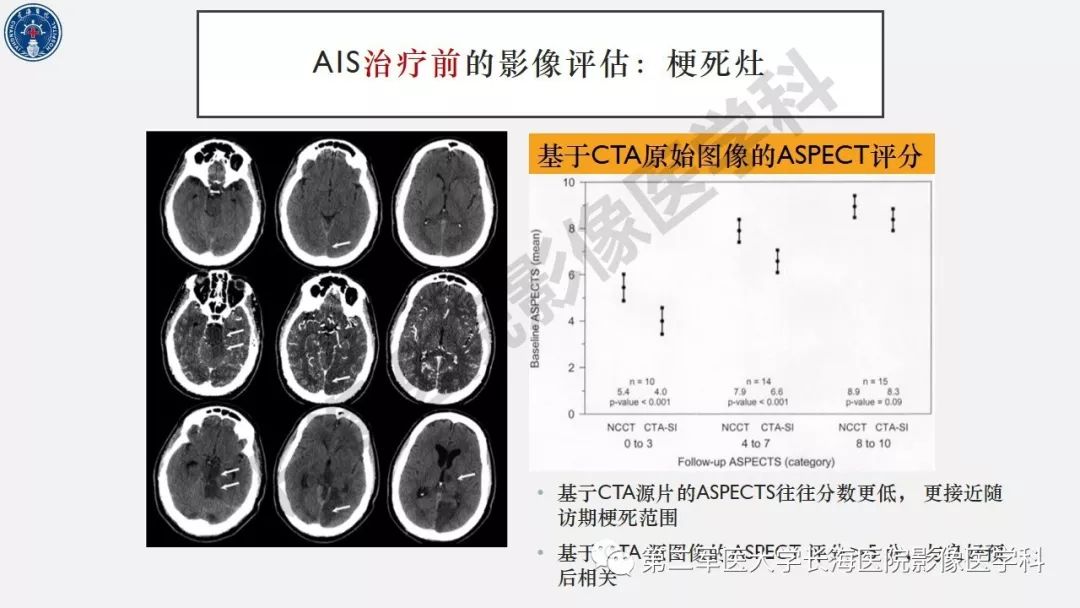 【PPT】2019中国《急性缺血性脑血管病影像指导规范》解读