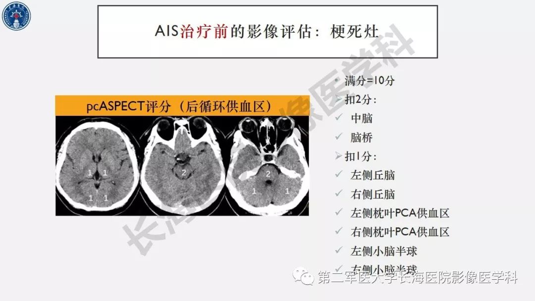 【PPT】2019中国《急性缺血性脑血管病影像指导规范》解读