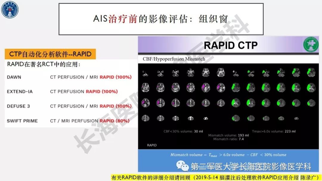 【PPT】2019中国《急性缺血性脑血管病影像指导规范》解读