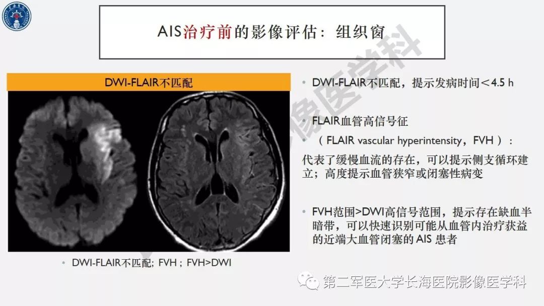【PPT】2019中国《急性缺血性脑血管病影像指导规范》解读