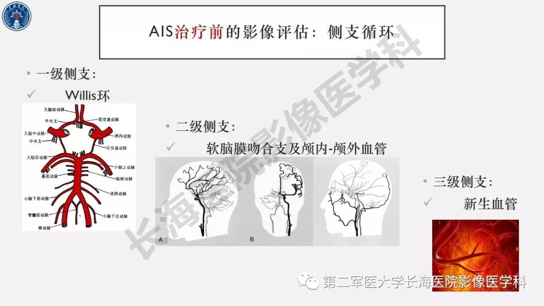 【PPT】2019中国《急性缺血性脑血管病影像指导规范》解读