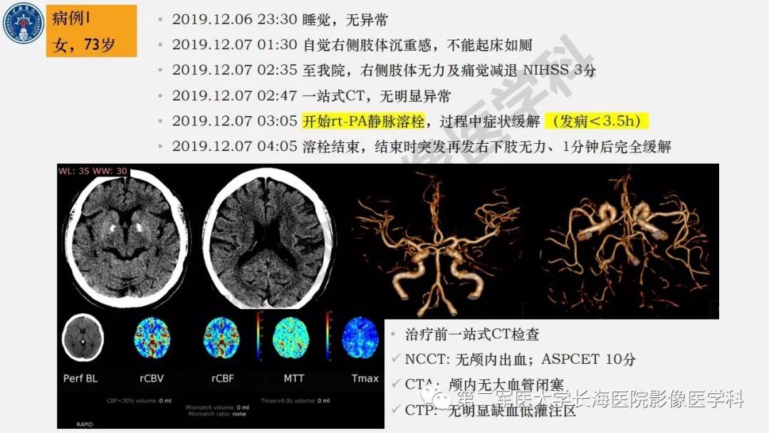 【PPT】2019中国《急性缺血性脑血管病影像指导规范》解读