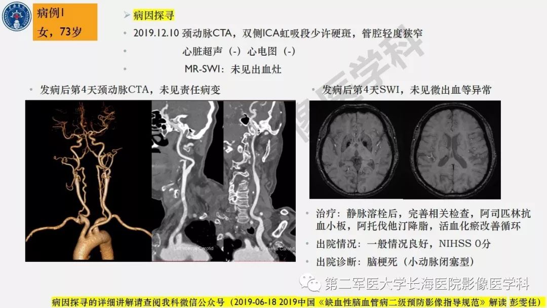 【PPT】2019中国《急性缺血性脑血管病影像指导规范》解读