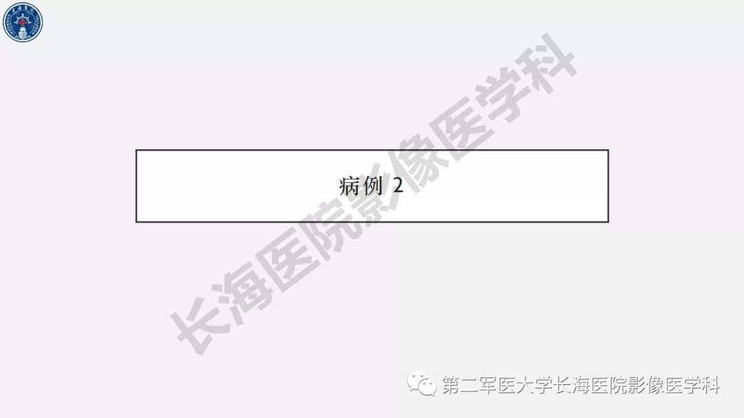【PPT】2019中国《急性缺血性脑血管病影像指导规范》解读