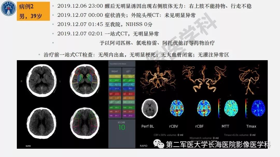 【PPT】2019中国《急性缺血性脑血管病影像指导规范》解读