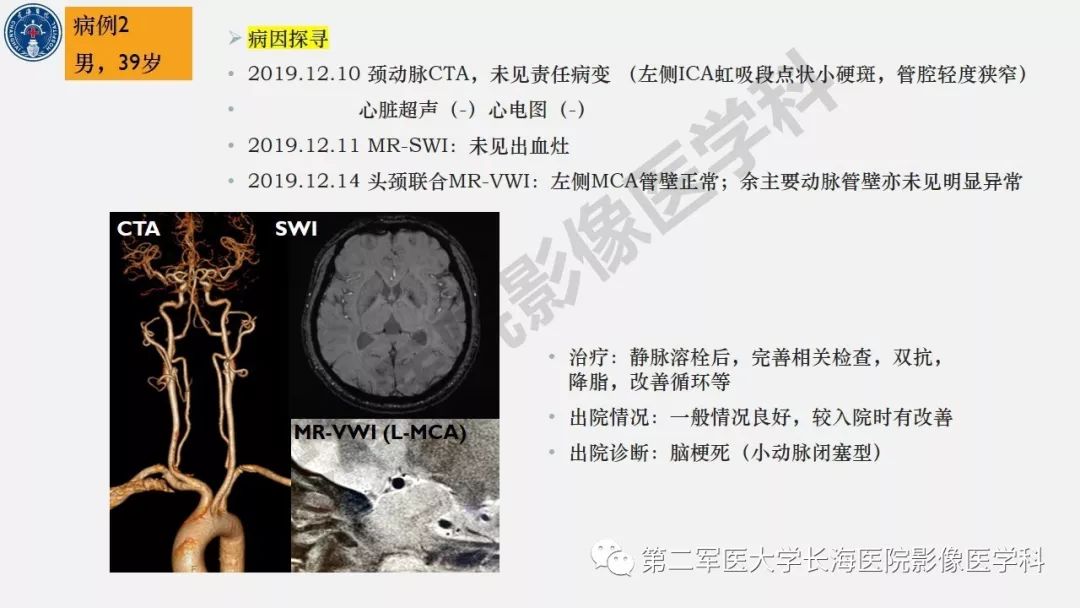 【PPT】2019中国《急性缺血性脑血管病影像指导规范》解读