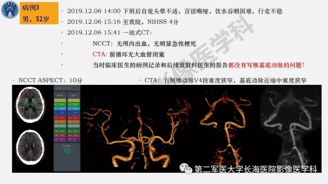 【PPT】2019中国《急性缺血性脑血管病影像指导规范》解读