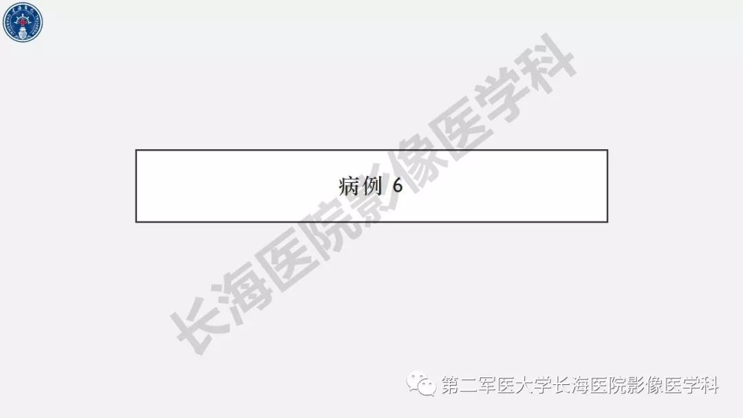 【PPT】2019中国《急性缺血性脑血管病影像指导规范》解读