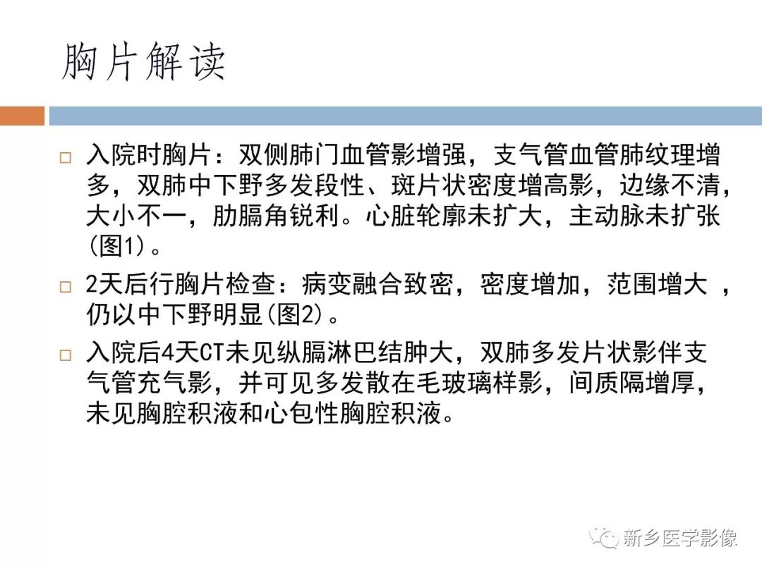 【PPT】2019新型冠状病毒肺炎影像学表现