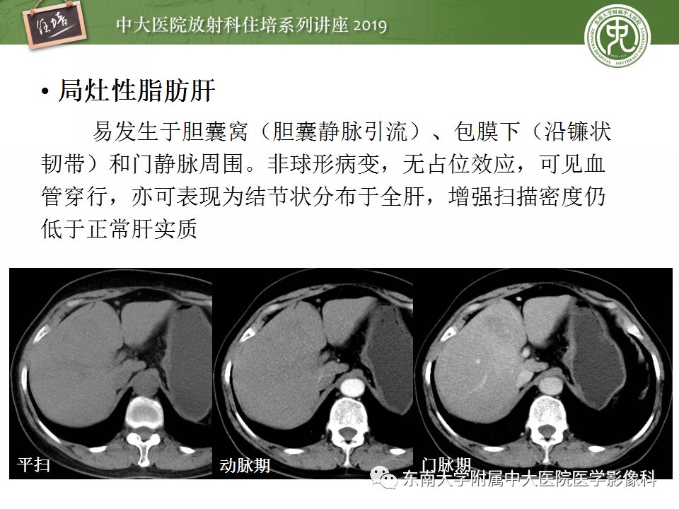 【PPT】肝脏弥漫性病变影像表现