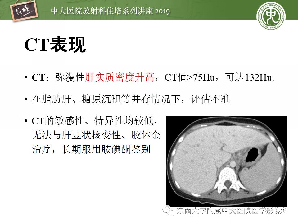 【PPT】肝脏弥漫性病变影像表现