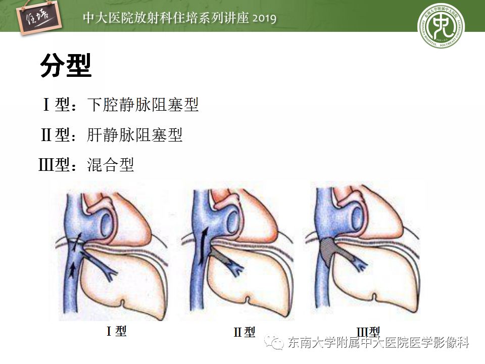 【PPT】肝脏弥漫性病变影像表现