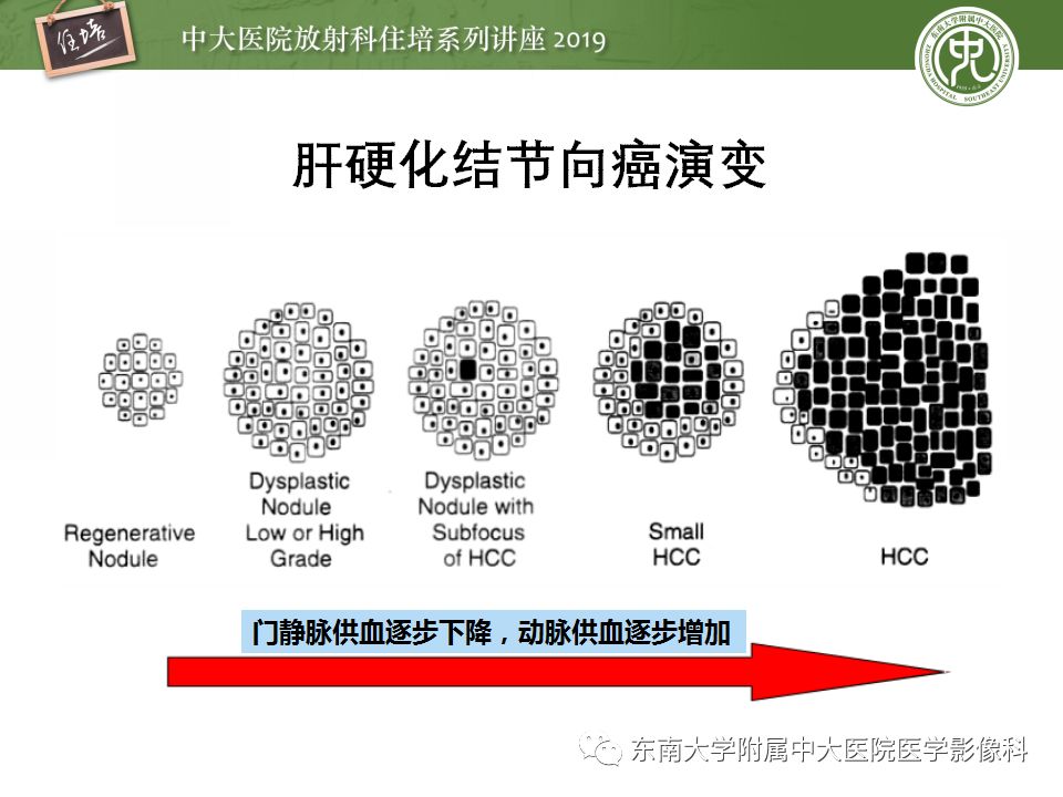 【PPT】肝脏弥漫性病变影像表现