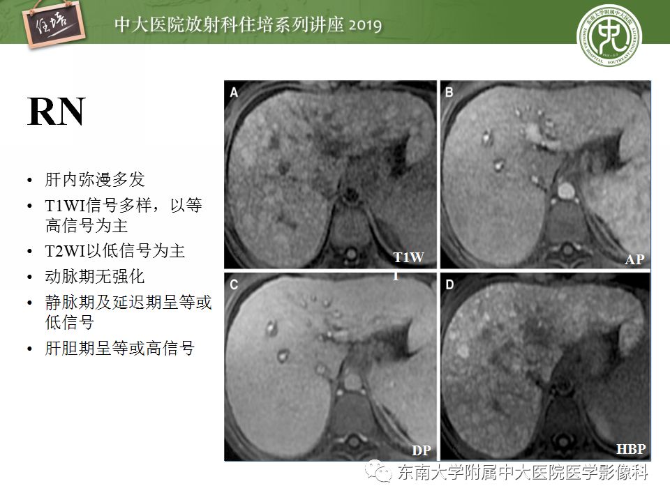 【PPT】肝脏弥漫性病变影像表现