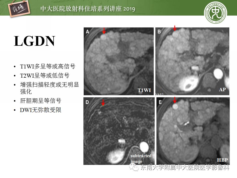 【PPT】肝脏弥漫性病变影像表现