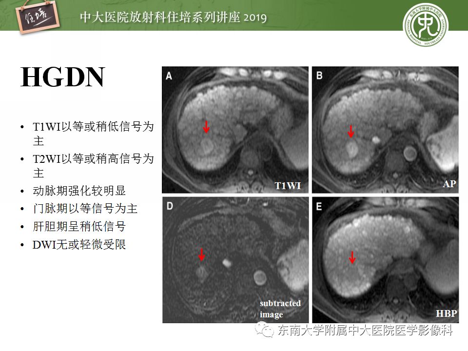 【PPT】肝脏弥漫性病变影像表现
