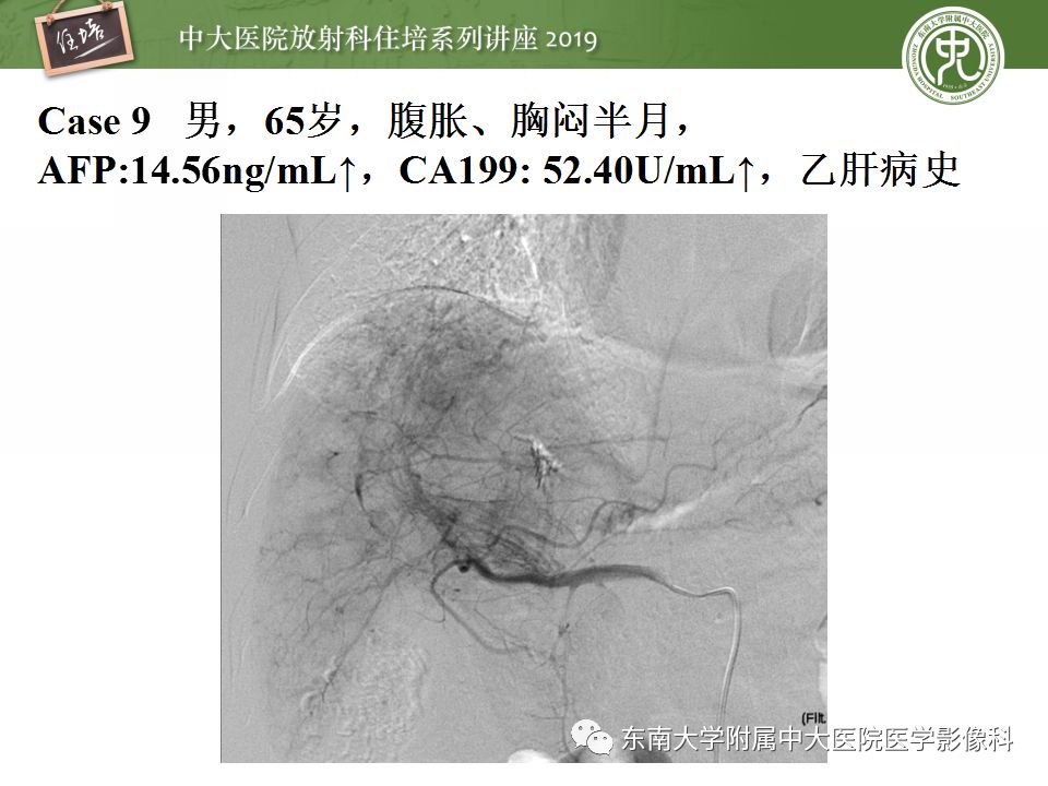 【PPT】肝脏弥漫性病变影像表现