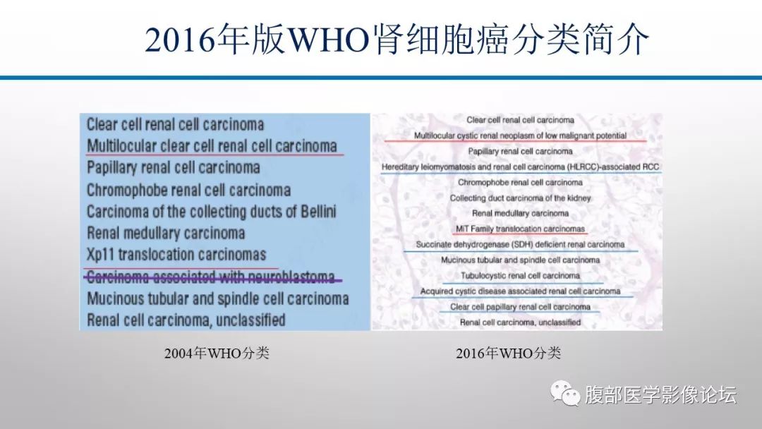 【病例】肾脏孤立性占位影像分析