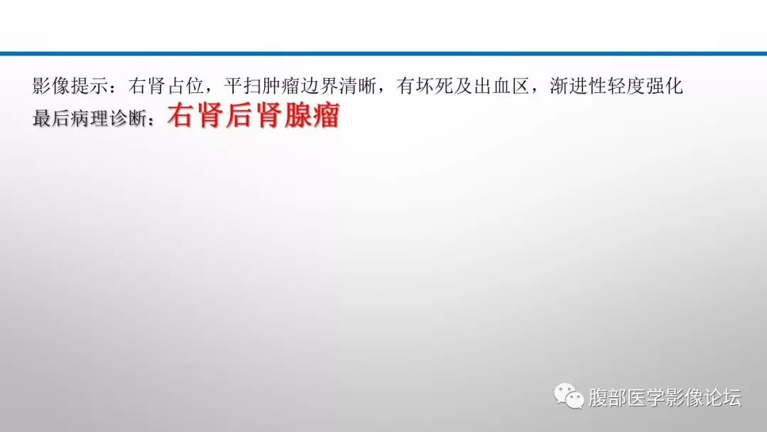 【病例】肾脏孤立性占位影像分析
