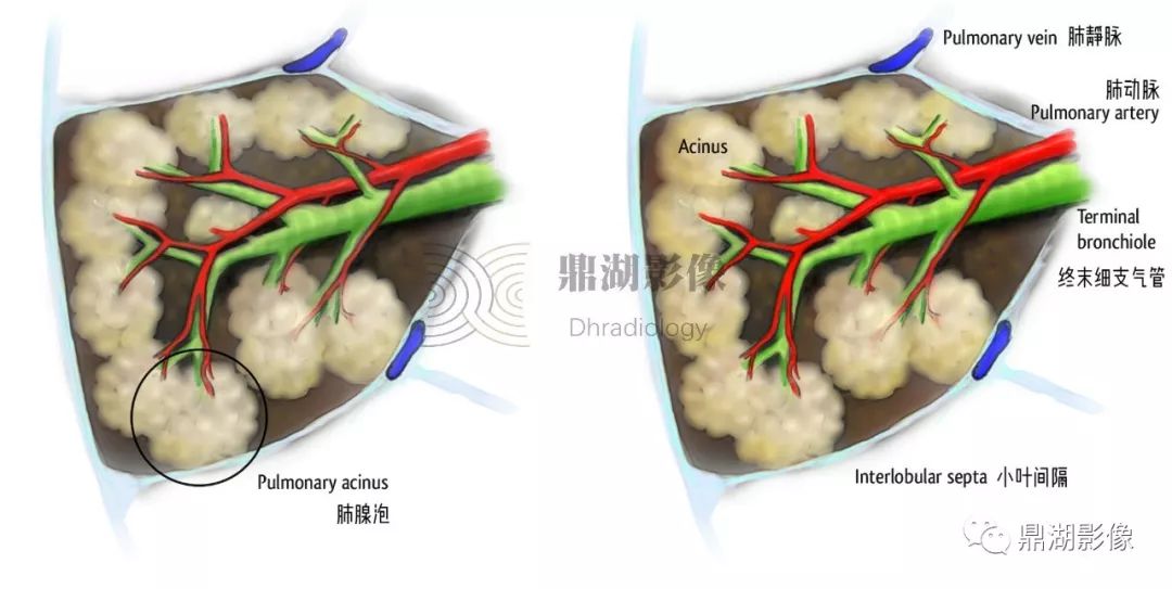 影像病理——COVID-19新型冠状病毒肺炎的“三字经”(附高清病例) 影像病理——COVID-19新型冠状病毒肺炎的“三字经”(附高清病例)