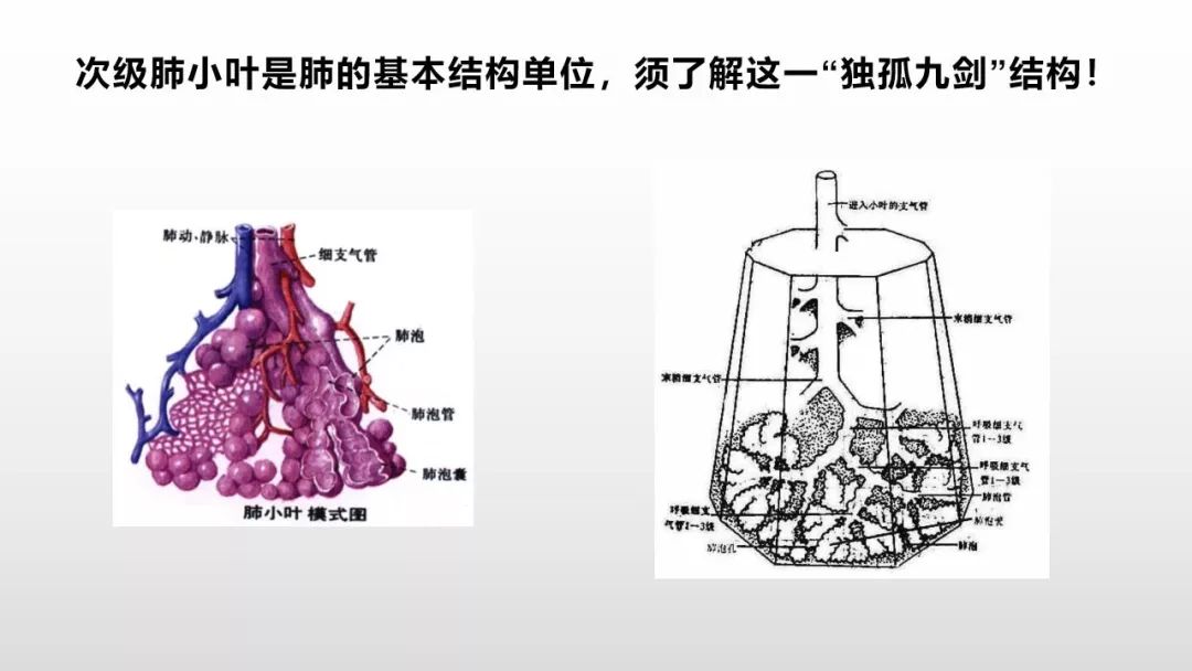 影像病理——COVID-19新型冠状病毒肺炎的“三字经”(附高清病例) 影像病理——COVID-19新型冠状病毒肺炎的“三字经”(附高清病例)