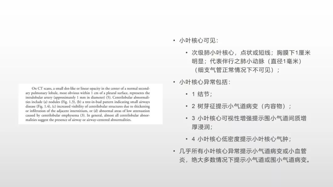 影像病理——COVID-19新型冠状病毒肺炎的“三字经”(附高清病例) 影像病理——COVID-19新型冠状病毒肺炎的“三字经”(附高清病例)