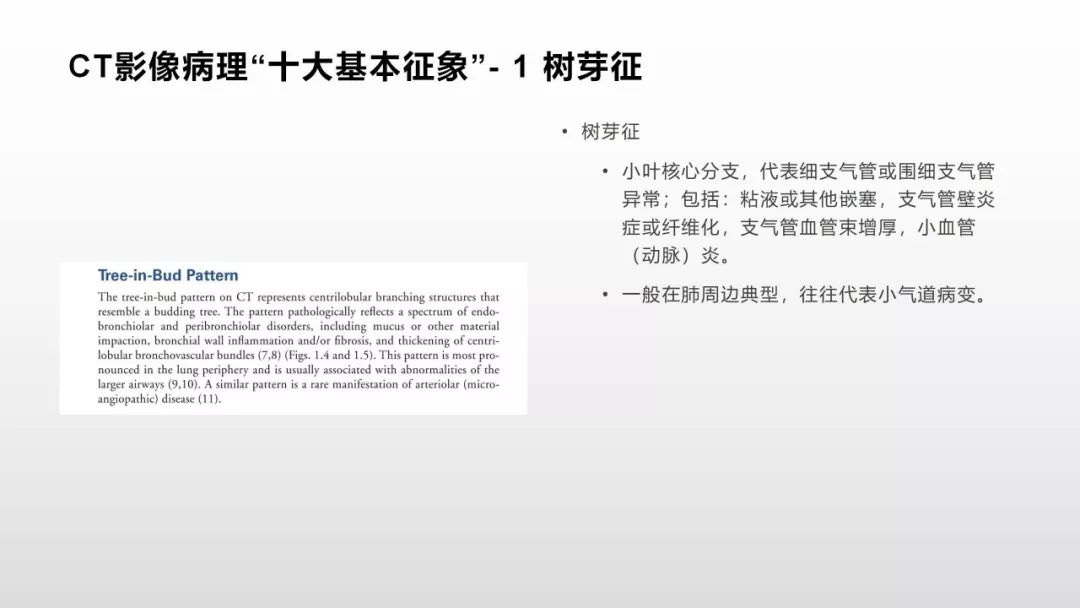 影像病理——COVID-19新型冠状病毒肺炎的“三字经”(附高清病例) 影像病理——COVID-19新型冠状病毒肺炎的“三字经”(附高清病例)