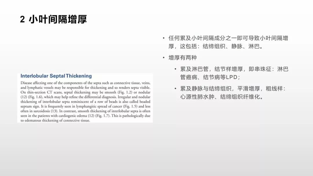 影像病理——COVID-19新型冠状病毒肺炎的“三字经”(附高清病例) 影像病理——COVID-19新型冠状病毒肺炎的“三字经”(附高清病例)