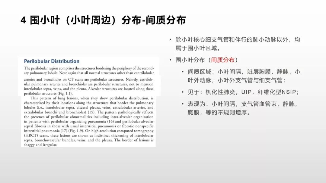 影像病理——COVID-19新型冠状病毒肺炎的“三字经”(附高清病例) 影像病理——COVID-19新型冠状病毒肺炎的“三字经”(附高清病例)