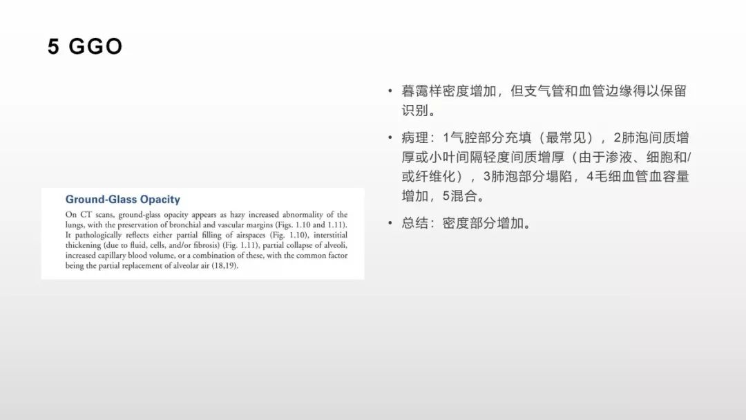 影像病理——COVID-19新型冠状病毒肺炎的“三字经”(附高清病例) 影像病理——COVID-19新型冠状病毒肺炎的“三字经”(附高清病例)