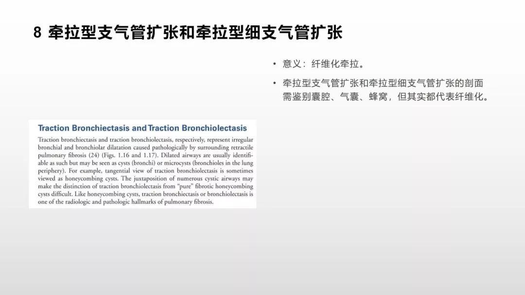 影像病理——COVID-19新型冠状病毒肺炎的“三字经”(附高清病例) 影像病理——COVID-19新型冠状病毒肺炎的“三字经”(附高清病例)