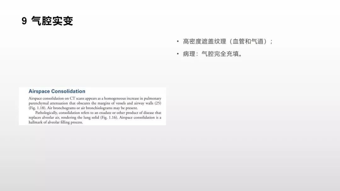 影像病理——COVID-19新型冠状病毒肺炎的“三字经”(附高清病例) 影像病理——COVID-19新型冠状病毒肺炎的“三字经”(附高清病例)