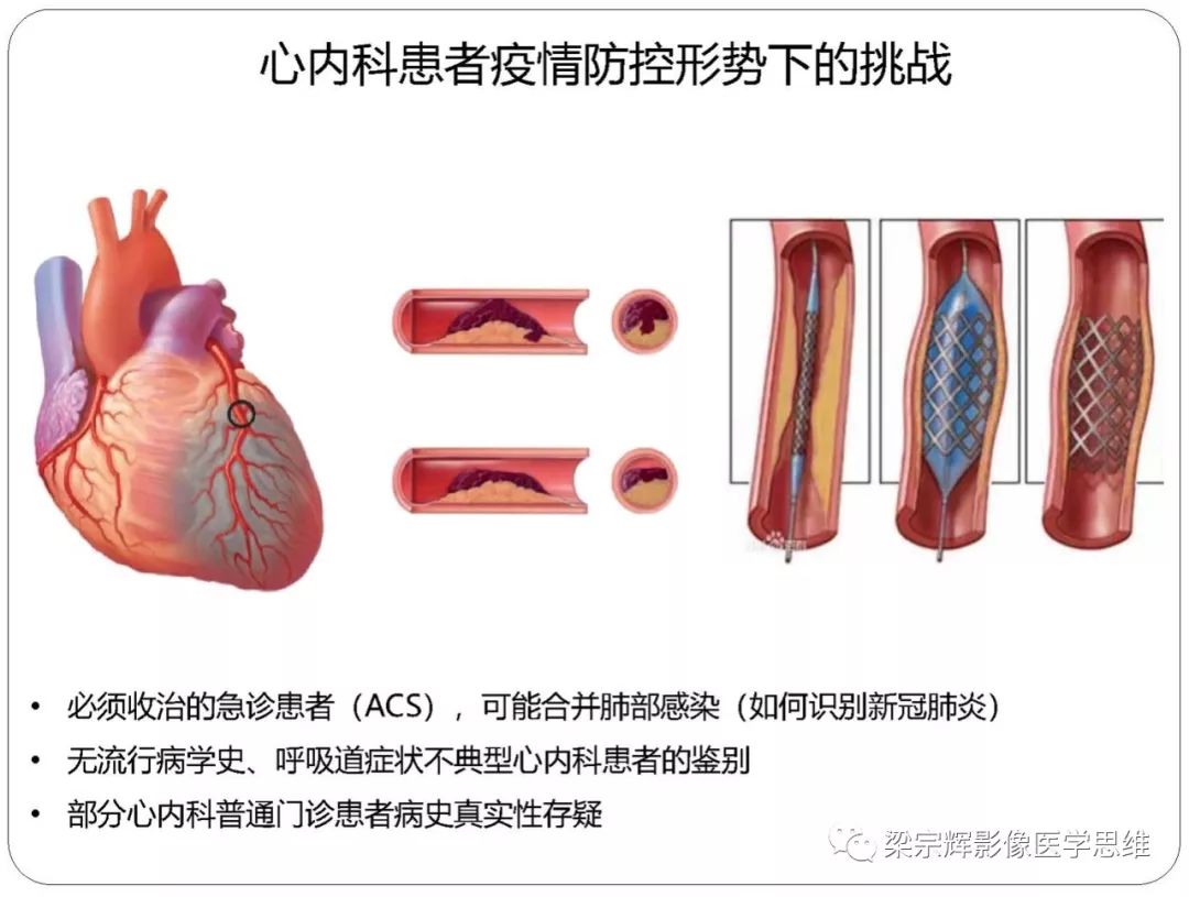 【PPT】新型冠状病毒肺炎影像学诊断与鉴别：心血管病医师需知