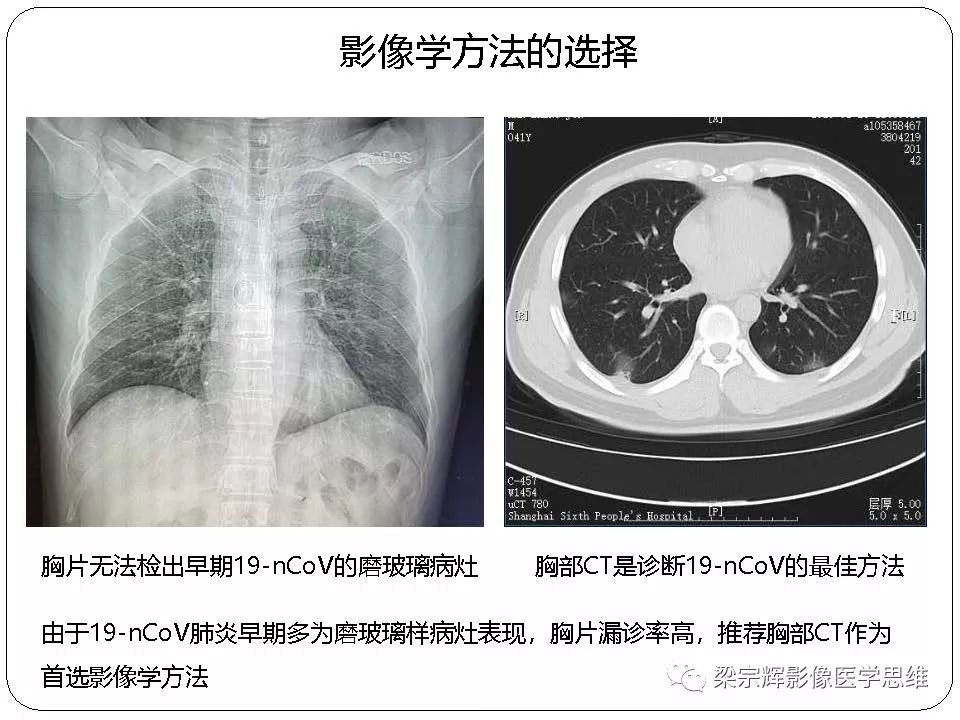 【PPT】新型冠状病毒肺炎影像学诊断与鉴别：心血管病医师需知