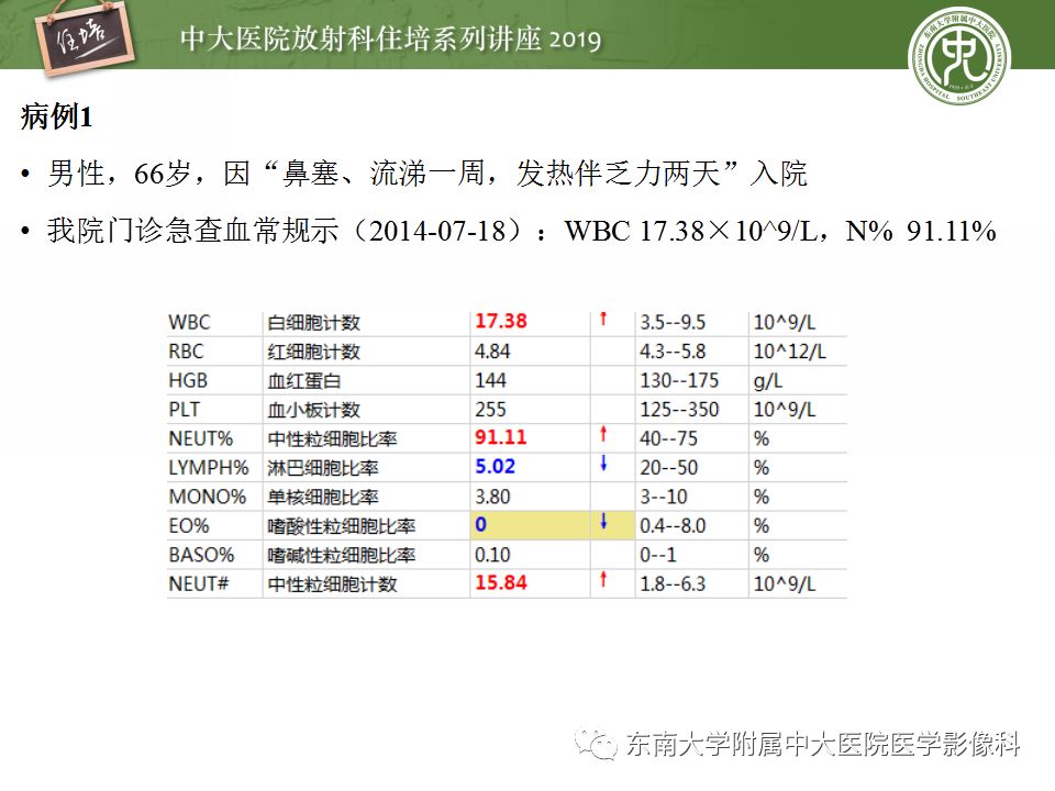 【PPT】脑脓肿的诊断与鉴别
