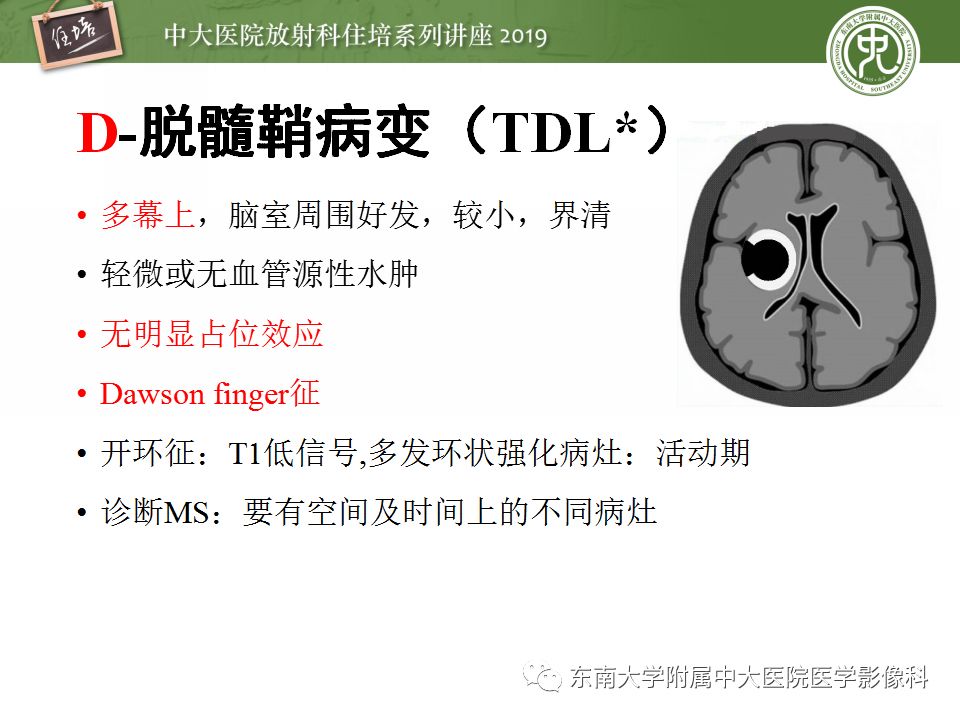 【PPT】脑脓肿的诊断与鉴别