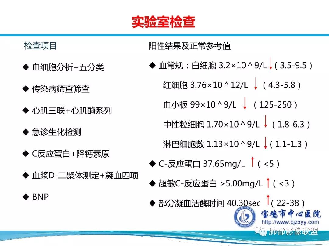 【PPT】宝鸡地区2019-nCoV肺炎确诊病例分享 【PPT】宝鸡地区2019-nCoV肺炎确诊病例分享