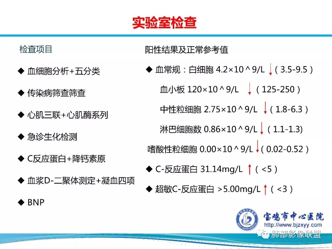 【PPT】宝鸡地区2019-nCoV肺炎确诊病例分享 【PPT】宝鸡地区2019-nCoV肺炎确诊病例分享
